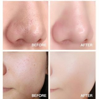 Mặt nạ sủi bọt Bơ hộp 10 gói