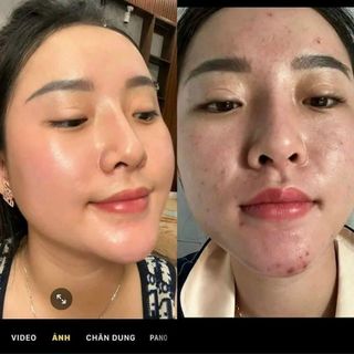 COMBO 2 HỘP KEM FACE CỐT NÁM VÀ KEM CỐT TRẮNG NÂNG CƠ NGÀY VÀ ĐÊM- NICOS BEAUTY