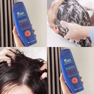 Dầu gội xả 2in1 Head and Shoulders Clinical Strength 400ml