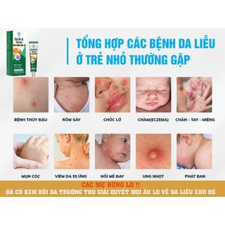 Kem Bôi Da Thảo Dược Trường Thọ Sinori 15g