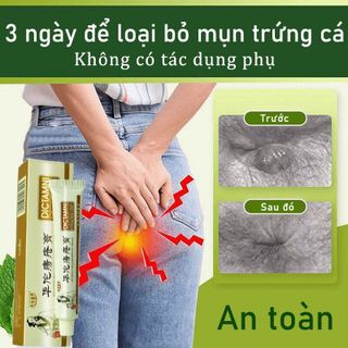 Thuốc Bôi Trĩ Nội Địa Trung