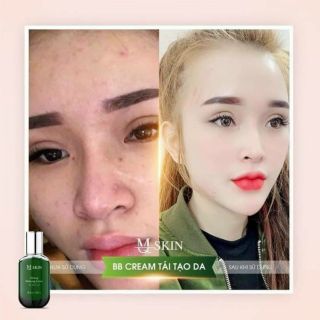 Bb cream tái tạo da mqskin