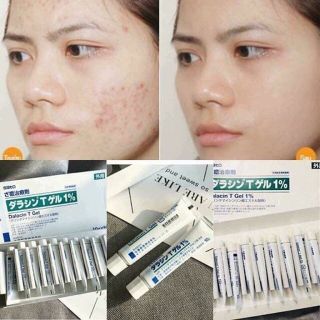 KEM TRỊ MỤN NHẬT BẢN DALACIN T GEL 1% - SILVER