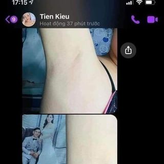 Kem Trị Thâm Nách Thái Lan Qnic