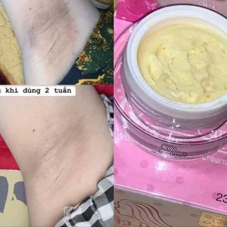 Kem Trị Thâm Nách Thái Lan Qnic