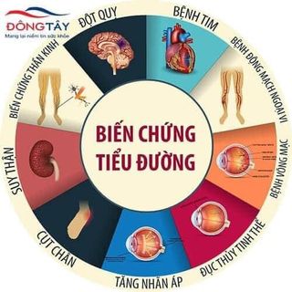 Cao dây thìa canh Mai Thị Thủy – Hạ đường huyết – Lọ 100g