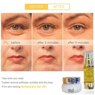 Combo Trắng Da White Skin Angel và Serum Gold 24K V&V Pro