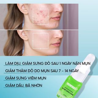 Serum mụn 2M Skin giúp nhanh gom còi mụn, giảm thâm và dịu da - Nhà Phân Phối Mỹ Phẩm Tấn Đạt
