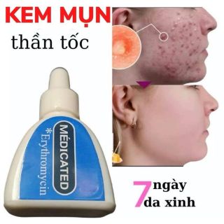 Kem Trị Mụn Sinh Học Nhật Bản Erythromycin