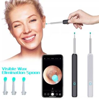 Dụng cụ lấy ráy tai có gắn camera nội soi đa năng