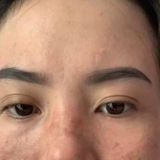 Kem Face Trị Nám Tàn Nhang Jussmy