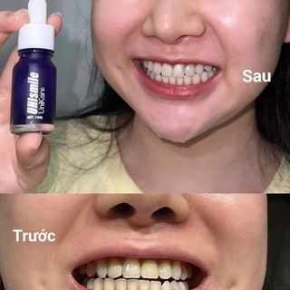 [ CHÍNH HÃNG ] Serum Trắng Răng Unismile, Hỗ Trợ Cải Thiện Vết Ố Vàng, Unikare, Dung Tích 10ml - LE'PEAU