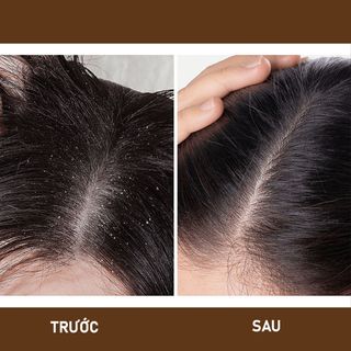 Dầu gội bồ kết, bưởi cô đặc, dầu gội thảo dược phụ hồi tóc, ngăn ngừa gãy rụng - Ngưu Cân Thảo 500ml