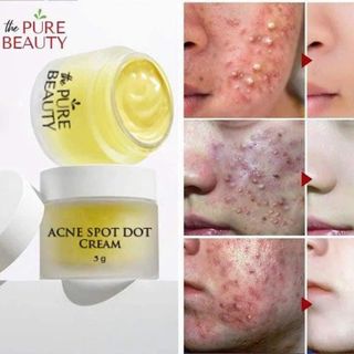 Kem mụn Acnes Spot Dot Cream