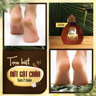 Mở trăn Thanh Nhi