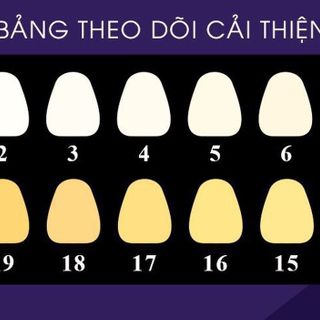 Serum hỗ trợ trắng răng sắc tím khử vàng 12ml