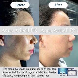 Dưỡng Chất Phục Hồi Sáng Bóng Cấp Ẩm Da Aqua Aribell PN Korea