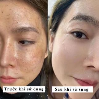 Kem mờ nám sáng da SKINHDOR 30g