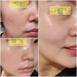 Tinh chất collagen tươi JM Collagen Multi Vita 28days Hàn Quốc