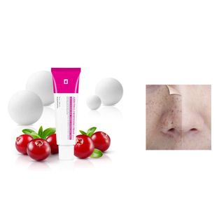 Kem dưỡng trắng trị nám Arbutin 5.0 Tosowoong 50ml Hàn Quốc