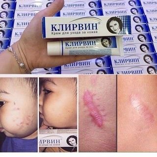 Kem sẹo Klirvin - Xóa mờ sẹo, thâm của Nga