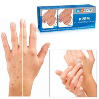 Kem Giảm Đồi Mồi Đốm Nâu Da Tay Kpem Từ Nga 50ml