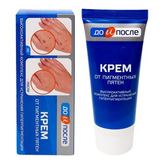Kem Giảm Đồi Mồi Đốm Nâu Da Tay Kpem Từ Nga 50ml