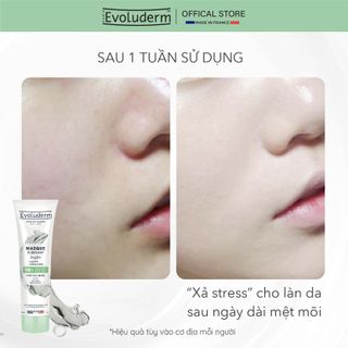 Mặt nạ dưỡng da Evoluderm Masque Purifiant Argile tinh chất đất sét xanh 150ml (Bao bì mới )