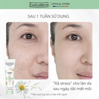 [ DATE 2025 ] Mặt nạ Evoluderm chính hãng tinh chất Hoa Cúc Chamomile làm dịu, mềm mịn da 150g