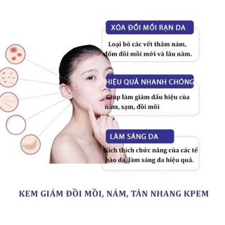 Kem Bôi Đồi Mồi Kpem Của Nga -  Kem Dưỡng Giúp Mờ Và Hồi Phục Các Đóm Đồi Mồi, Nám, Tàn Nhan Kpem 50ml giá sỉ