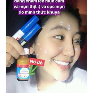 Huyền dịch lotion Nga loại bỏ mụn Propeller (mẫu mới)