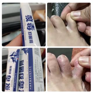 Kem Mỡ Trị Kháng khuẩn Trị Ngứa cac bệnh lý Da như nấm, lang ben, dị ứng, mục nước ( Hàng Giá tận Xưởng )