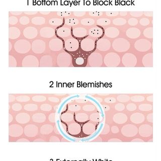 Kem đặc Trị Nám HIISEES , tàn nhan, đồi mồi được nhiều nước chuyên dùng 20g ( Hàng Giá Tận Xưởng )