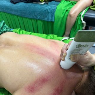 KEM MASSAGE BODY TEELA - TRỊ ĐAU NHỨC XƯƠNG KHỚP- CỔ VAI GÁY