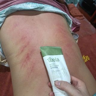 KEM MASSAGE BODY TEELA - TRỊ ĐAU NHỨC XƯƠNG KHỚP- CỔ VAI GÁY