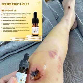 Serum phục hồi
