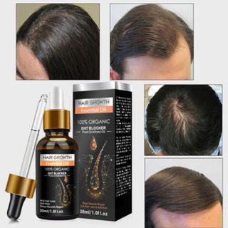 Tinh dầu dưỡng tóc sâu chic 30ml cho salon hair growth serum giải pháp dinh dưỡng dầu chăm sóc da đầu dày đặc