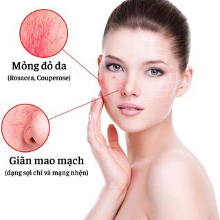 Kem Phục Hồi Kích Ứng Da Couperose Balm, Giãn Mao Mạch, Da Mỏng Yếu Đỏ, Mụn Trứng Cá Đỏ