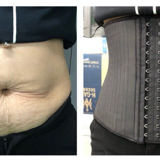 Voronin 11 xương giá sỉ