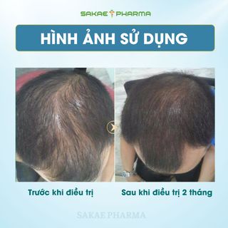 ZAHA Roy Shampoo Men Dầu Gội Kích Thích Mọc Tóc, Ngăn Ngừa Rụng Tóc và Hói Đầu Ở Nam Giới
