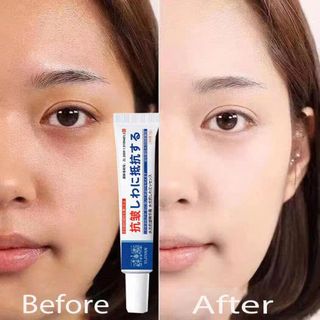 Kem Ngừa Nám Trẻ Hóa UCM Nhật Bản 20g