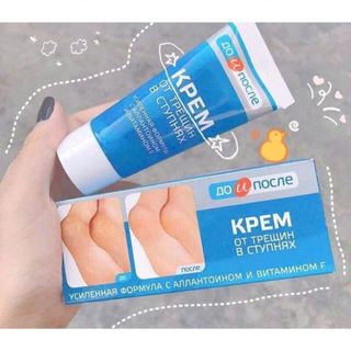 Kem Nứt Gót Chân Nga 50ml
