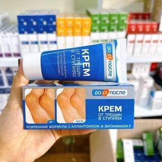 Kem Nứt Gót Chân Nga 50ml