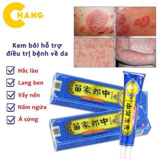 Kem đông y Trung Quốc trị viêm da, nấm ngứa, hắc lào