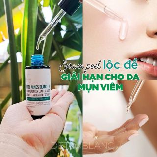 Serum mụn detox H