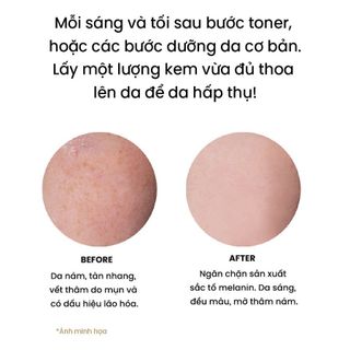 [WHISIS Cao Cấp] Kem Phức Hợp Dưỡng Trắng Da Mờ Thâm Nám Tàn Nhang WHISIS Premium MELASMA Care Complex Cream 50g