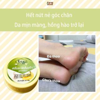 Kem Nứt Gót Chân The Banana Cream Heels
