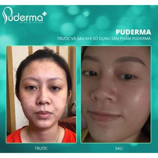 Kem Dưỡng Da Ban Ngày Puderma Anti-Pollution Brightening Day Cream 50ml: Nâng Cơ, Bật Tone