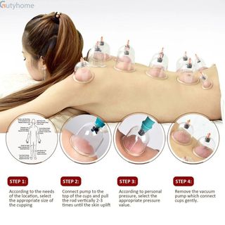 BỘ GIÁC HƠI 12 ỐNG HÚT CHÂN KHÔNG