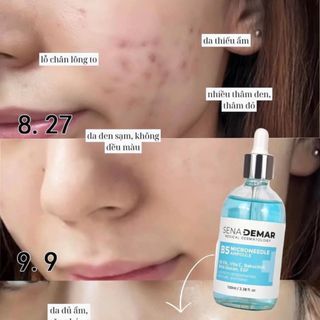 Senaderma serum B5 cấp ẩm phục hồi